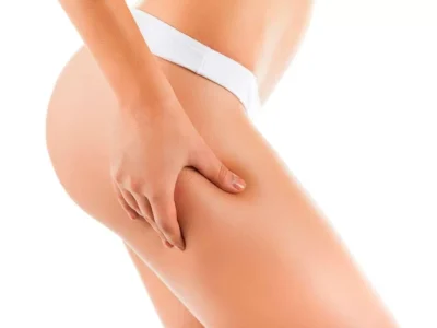 Carbossiterapia corpo